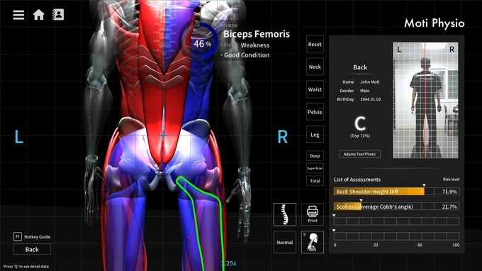 모티피지오, 영국 버밍엄 테라피 엑스포 참가 - 뉴스 썸네일 이미지