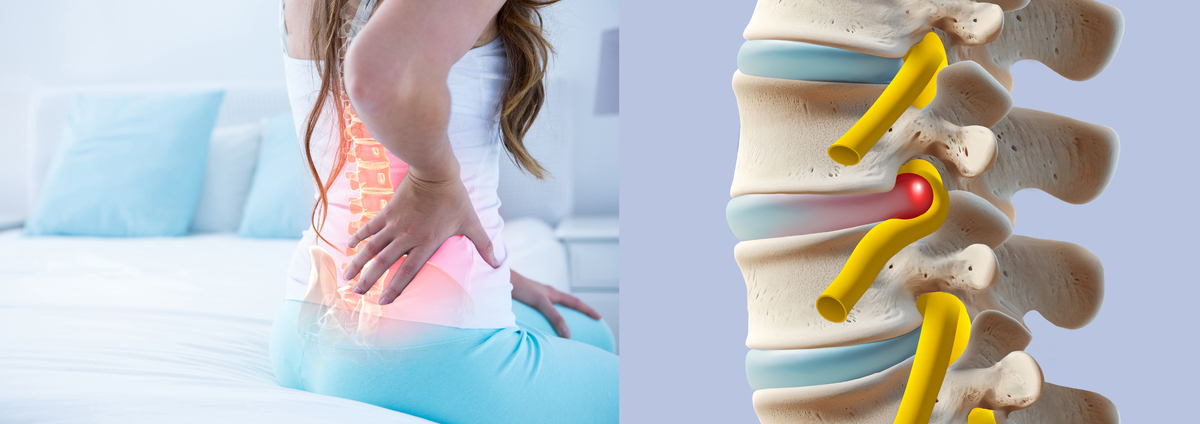 Digital composite of highlighted spine of woman with back pain at home